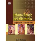 Infarto Agudo del Miocardio. Diagnóstico y Tratamiento-(Sin marca)